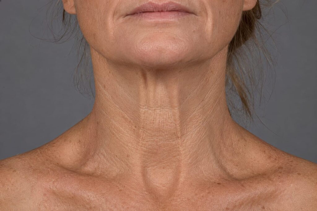 The Midlife Shift: Understanding Crepey Neck Skin Menopause